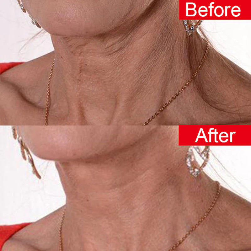 Neck Wrinkle Pads Sticker,Wrinkle Face Mask, Gift for Women
