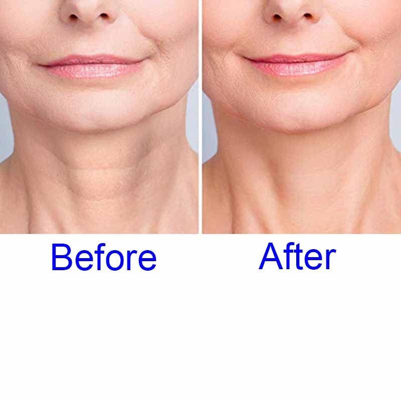 Neck Wrinkle Pads Sticker,Wrinkle Face Mask, Gift for Women