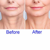 Neck Wrinkle Pads Sticker,Wrinkle Face Mask, Gift for Women