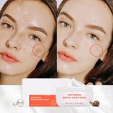 Powerful Whitening Freckle Cream Remove Acne Spots Melanin Dark Spots Face Lift Firming Face Skin Care Beauty Essentials