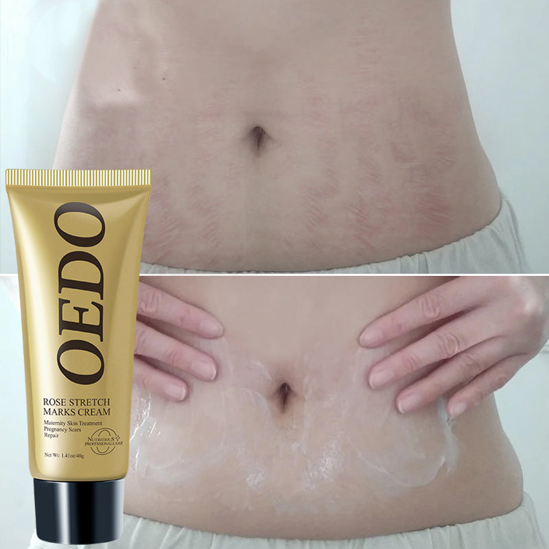 Rose Remove Stretch Marks Cream Anti Wrinkle Anti Aging Maternity Skin Repair Remove Pregnancy Scars Treatment Body Skin Care