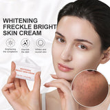 Powerful Whitening Freckle Cream Remove Acne Spots Melanin Dark Spots Face Lift Firming Face Skin Care Beauty Essentials