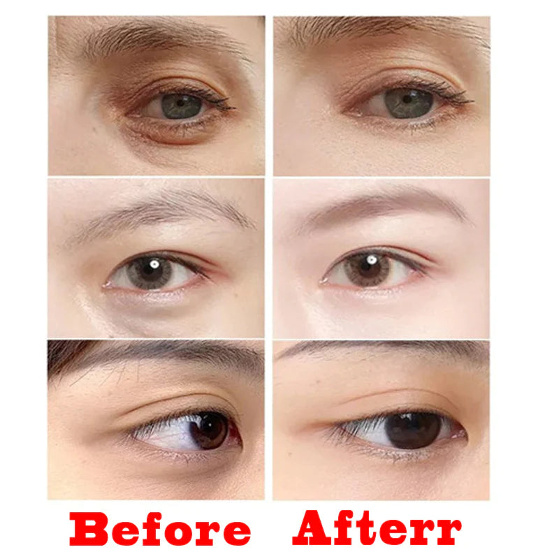 Anti-Wrinkle Eye Facial Skin Lifting Sticker for Wrinkle Removal