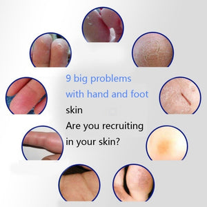 Smooth Multi Balm Stick Wrinkle Anti-Dry Cracked Foot Hand Cream Moisturizing Hand Feet Care 40g