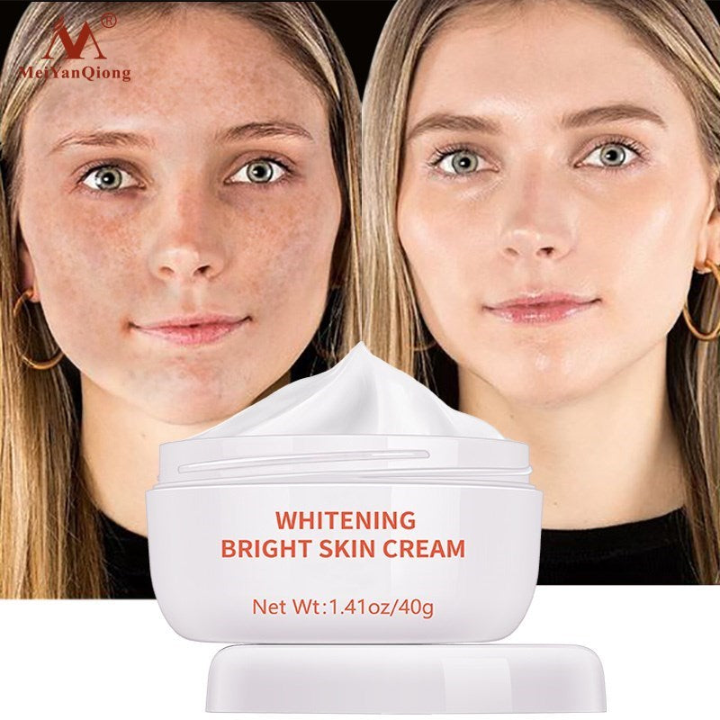 Powerful Whitening Freckle Cream Remove Acne Spots Melanin Dark Spots Face Lift Firming Face Skin Care Beauty Essentials